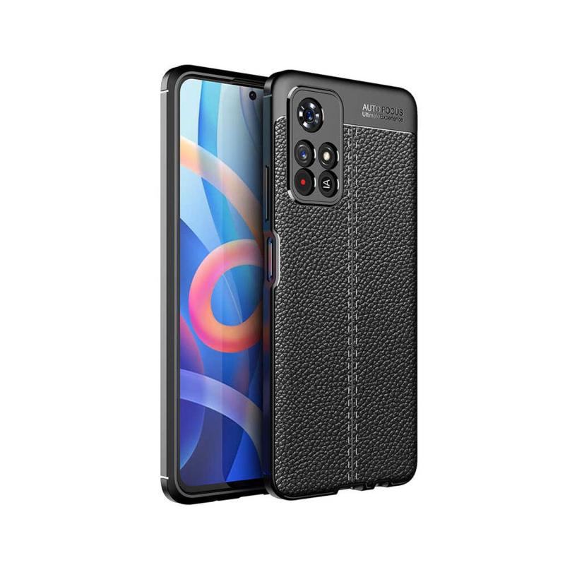 Forzacase%20Xiaomi%20Redmi%20Note%2011%20Pro%20Plus%205G%20ile%20uyumlu%20Deri%20Effect%20Serisi%20Silikon%20Kılıf