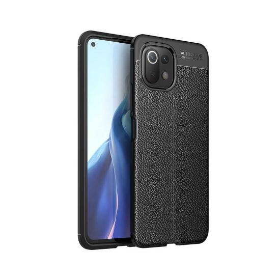 Forzacase Xiaomi Mi 11 Lite ile uyumlu Deri Effect Serisi Silikon Kılıf